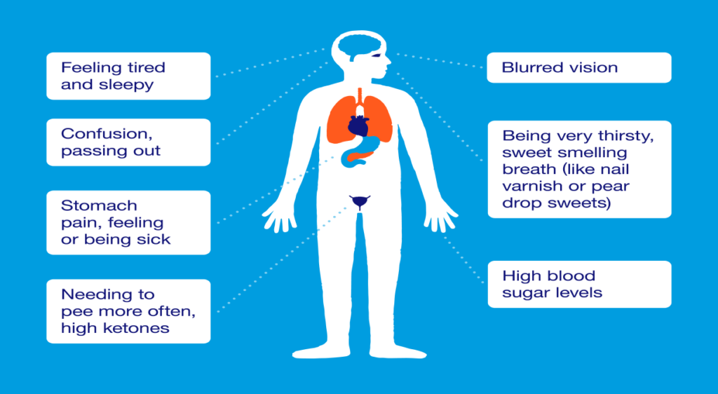 Different types of Diabetes