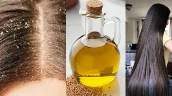 benefits of mustard oil for hair


