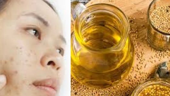 is mustard oil good for your skin
